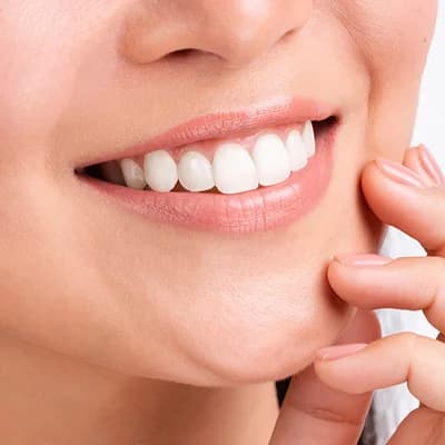 Tooth Whitening: Brighten Your Smile with Confidence
